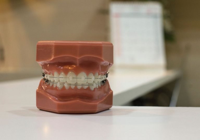 What You Need to Know About Your Wisdom Teeth